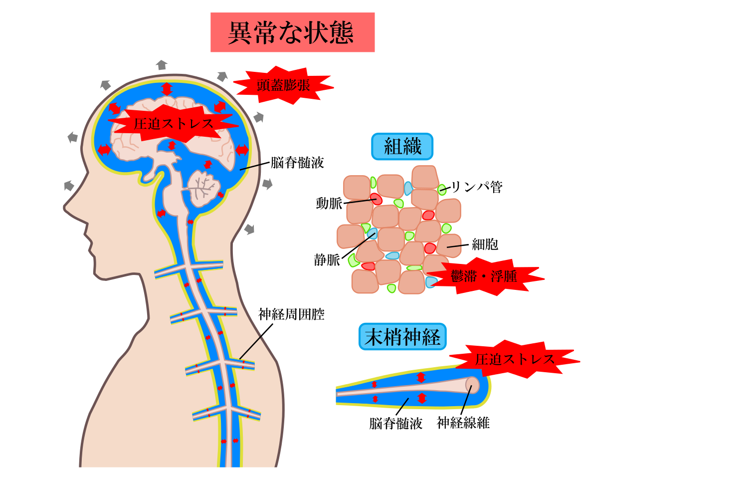 異常脳脊髄液の循環